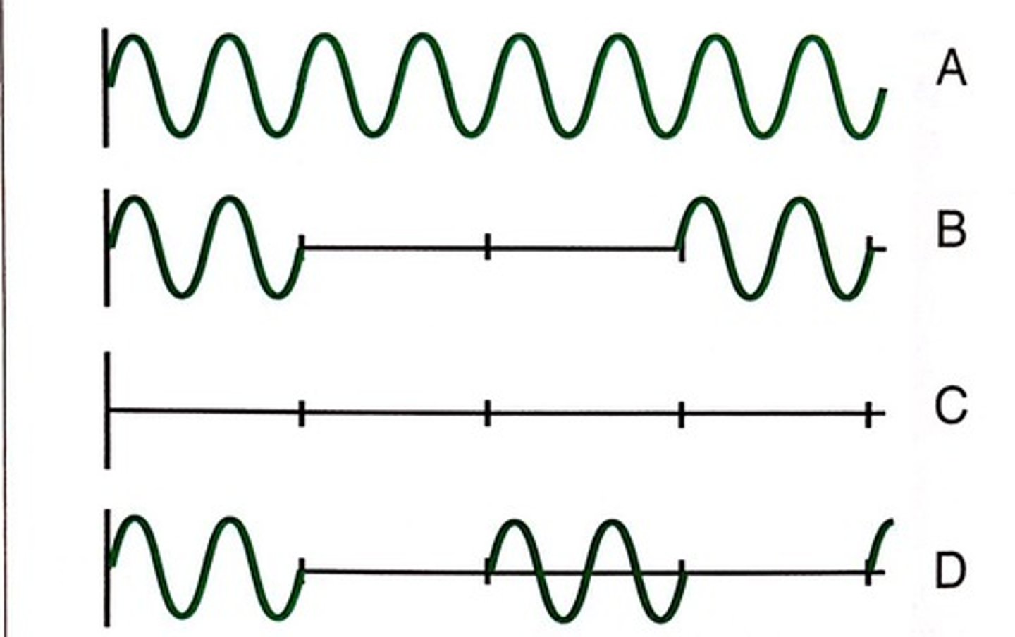 <p>Choice D has the shallowest imaging depth because the pulse repetition period is the shortest.</p>