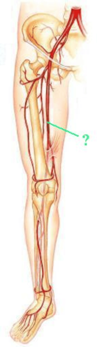 <p>Identify the indicated blood vessel.</p>