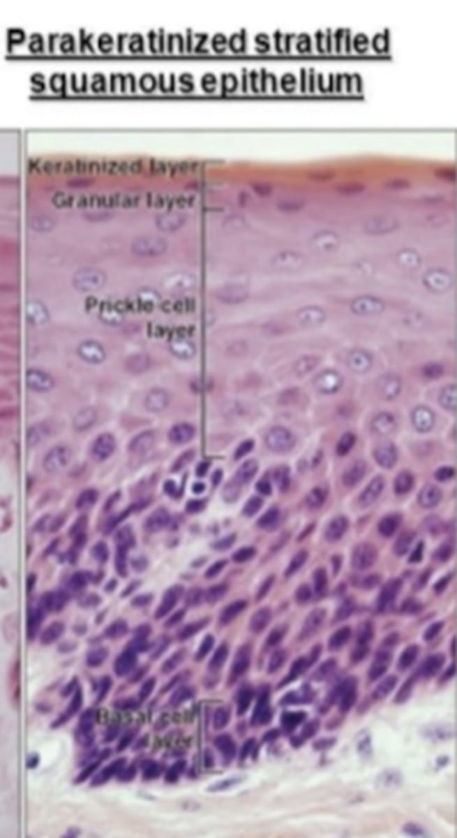 <p>parakeratinized epithelium</p><p>-masticatory mucosa</p>
