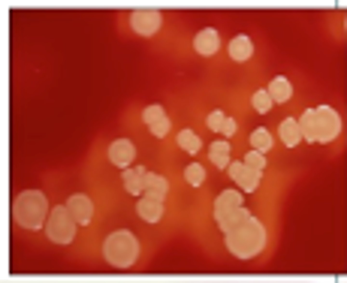 <p>Beta hemolytic</p>