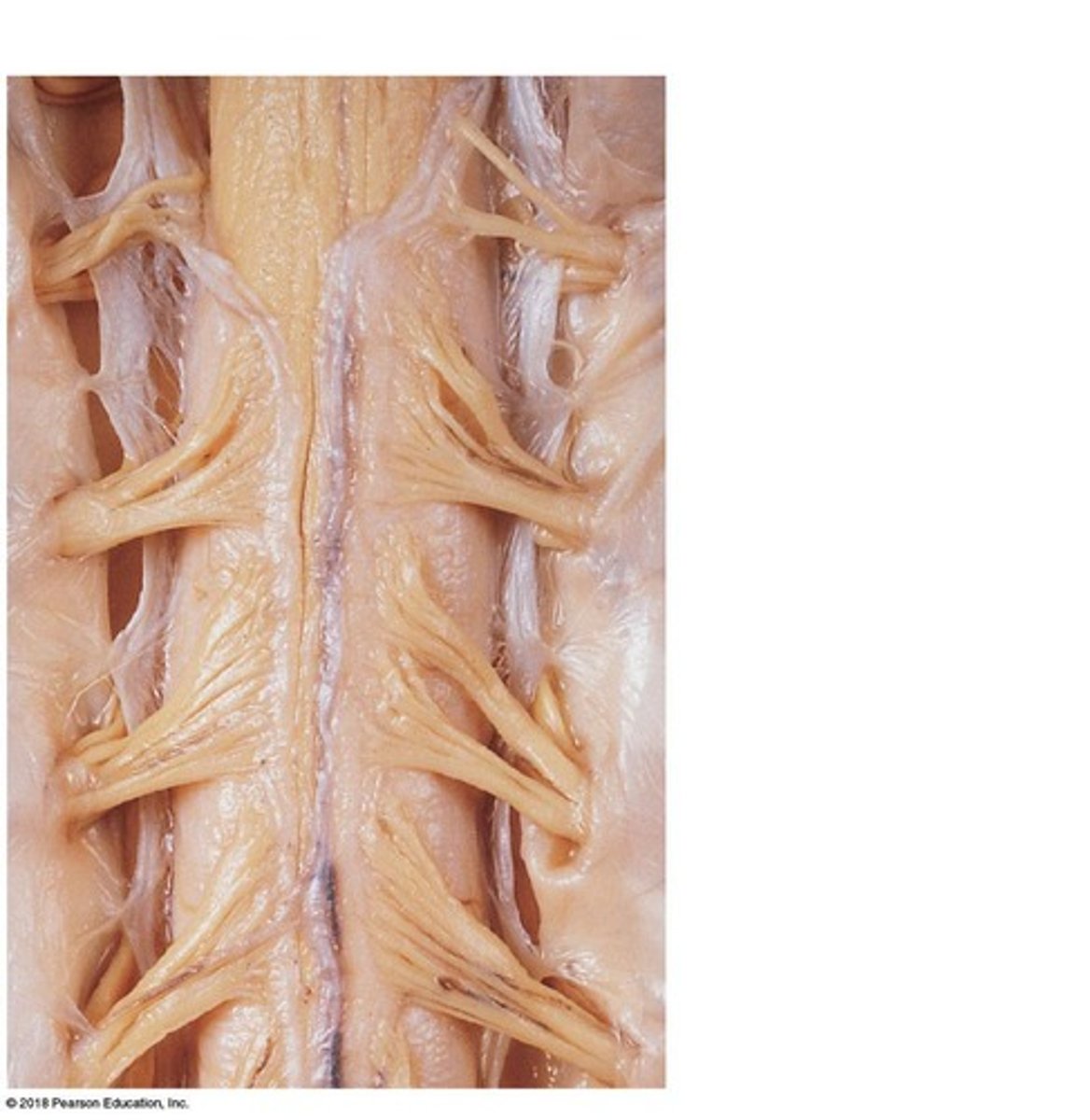 <p>contain cell bodies of sensory neurons</p>
