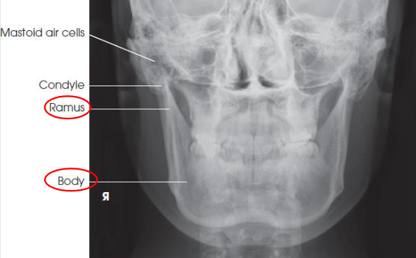 <ul><li><p>mandibular body and rami</p></li><li><p>central part of body not well shown due to superimposition</p></li><li><p>shows medial or lateral displacement of fragments in fractures of the rami</p></li><li><p>no rotation or tilt:</p><ul><li><p>symmetric mandibular body and rami</p></li><li><p>MSP of head aligned with long axis of collimated field</p></li></ul></li></ul><p></p>