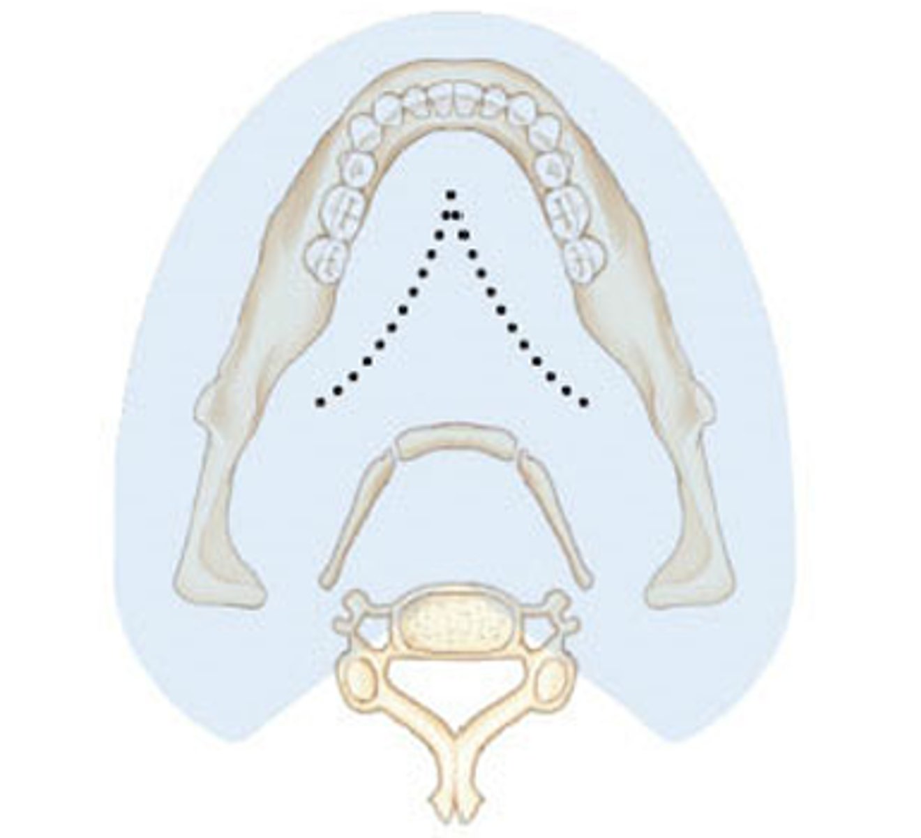 <p>The structures outlined in blue indicate what type of image?</p><p>A) real image</p><p>B) double real image</p><p>C) ghost image</p>
