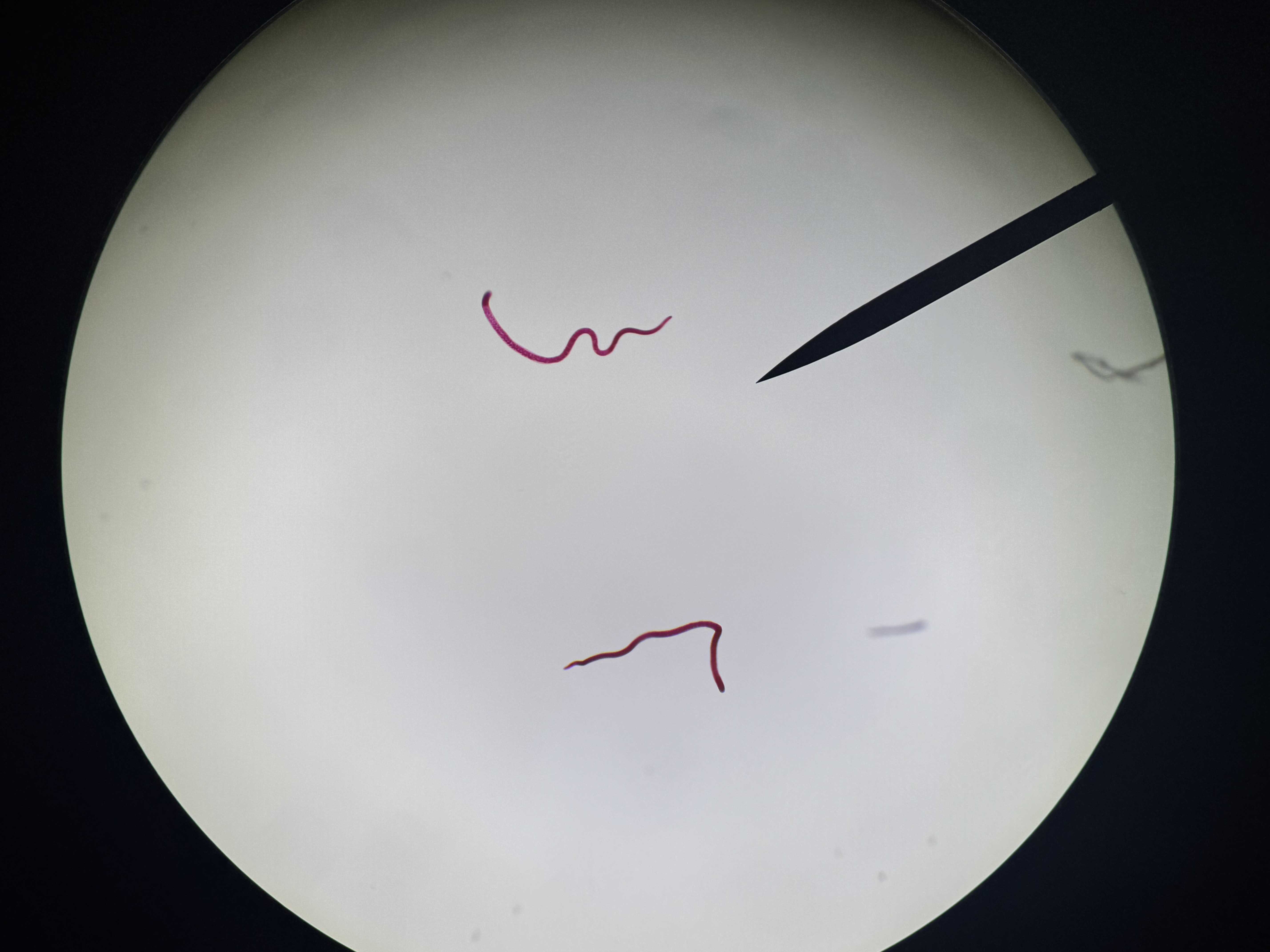 <p>Trichinella spiralis</p>