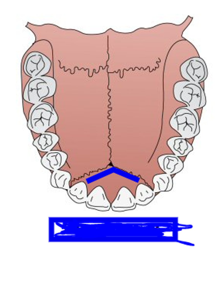 <p>between palatine processes and premaxilla, seen in younger individuals</p>