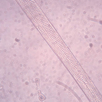 <p>Is this muscle fiber relaxed or contracted?</p>
