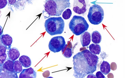 <p>Lymph node cytology</p><p>Enlarged lymph nodes - disease</p><p>Reactive or hyperplastic lymph node</p><p>What is the red arrow? Features of each?</p><p>Blue arrow?</p>