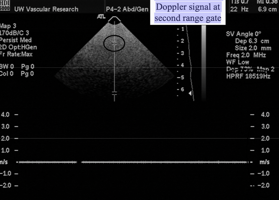 <p>What is "High PRF" mode and what artifact can it cause?</p>