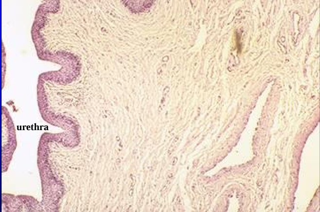 <p>Penile urethra, equine penis. </p><p>The <strong>epithelium lining the penile urethra</strong> at the level of this section is in <strong>transition from stratified cuboidal to stratified squamous. </strong></p><p>Erectile tissue is present in the lamina propria</p>