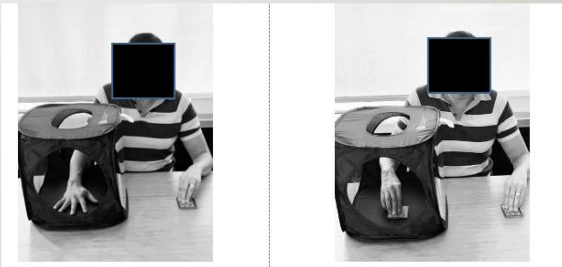 <ul><li><p><strong><u>Bimanual Mirror Therapy</u></strong></p><ul><li><p><strong><u>trying to move</u></strong> (the <strong><u>hand inside the box</u></strong>) <strong><u>as much as possible</u></strong>; <strong><u>trying to duplicate the strong arm&nbsp;</u></strong></p></li></ul></li><li><p><strong><u>Unimanual Mirror Therapy</u></strong></p><ul><li><p><strong><u>hand</u></strong> (<strong><u>inside of the box</u></strong>) <strong><u>sits in there and does nothing</u></strong>; the <strong><u>patient solely observes the strong arm without attempting to duplicate it</u></strong></p></li><li><p><strong><u>research actually shows better improvements w/ this version</u></strong>, as the <strong><u>different feedback/conflict in bimanual mirror therapy</u></strong> (<strong><u>when the impaired side is unable to replicate the same movements as the strong arm</u></strong>) <strong><u>makes results worse&nbsp;</u></strong></p></li></ul></li><li><p>Who is a <strong><u>candidate?</u></strong></p><ul><li><p><strong><u>Acute, subacute, chronic stroke</u></strong></p></li><li><p><strong><u>Cognitively able to follow directions</u></strong> and <strong><u>attend to tasks</u></strong></p></li><li><p><strong><u>No severe visual or perceptual deficits</u></strong></p></li><li><p><strong><u>No motor requirements</u></strong> (<strong><u>However, for research, they may need some movement</u></strong>)</p></li></ul></li></ul><p></p>