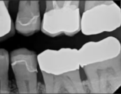 <p>14</p>