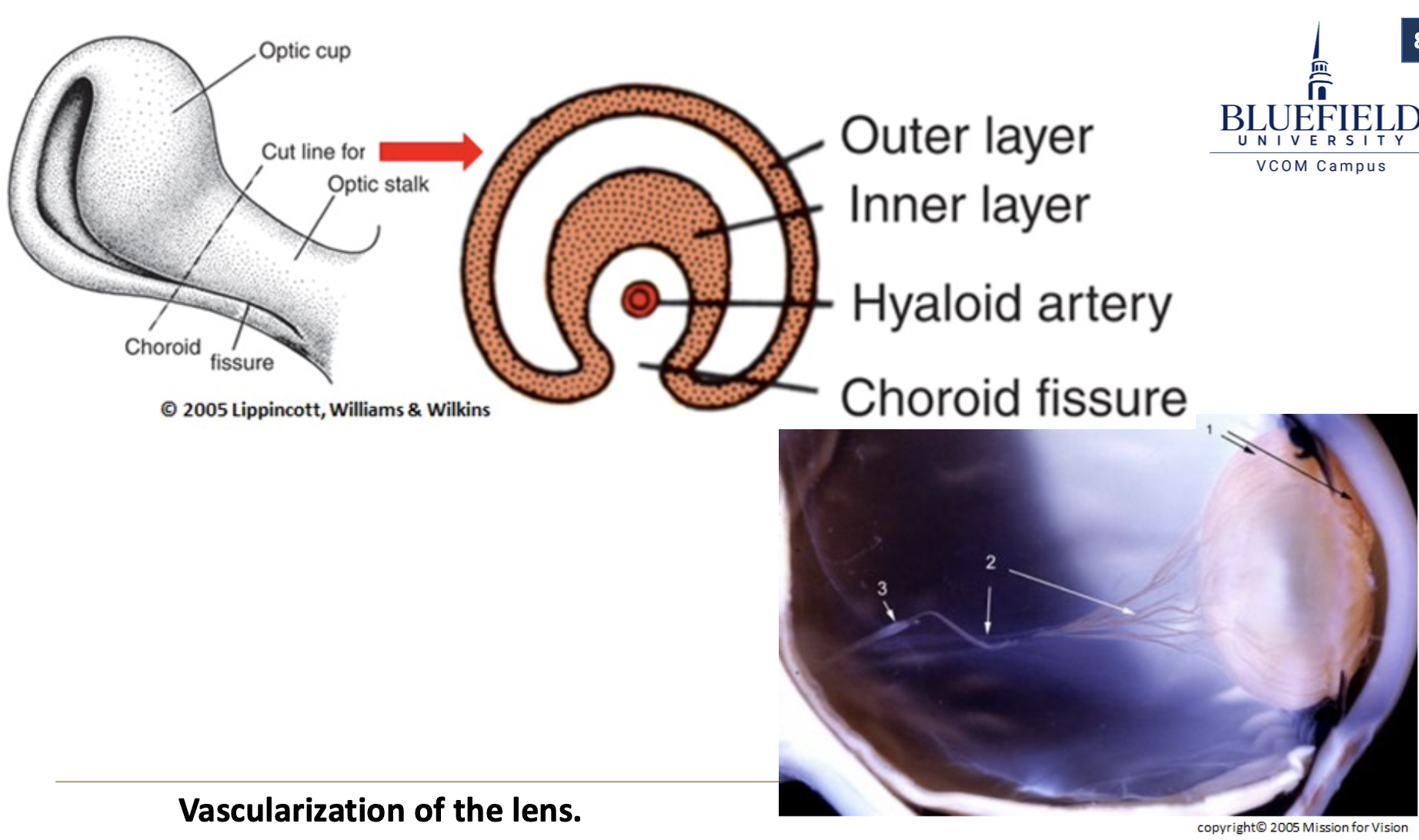 <p>When do the lips of the optic fissure fuse?</p>