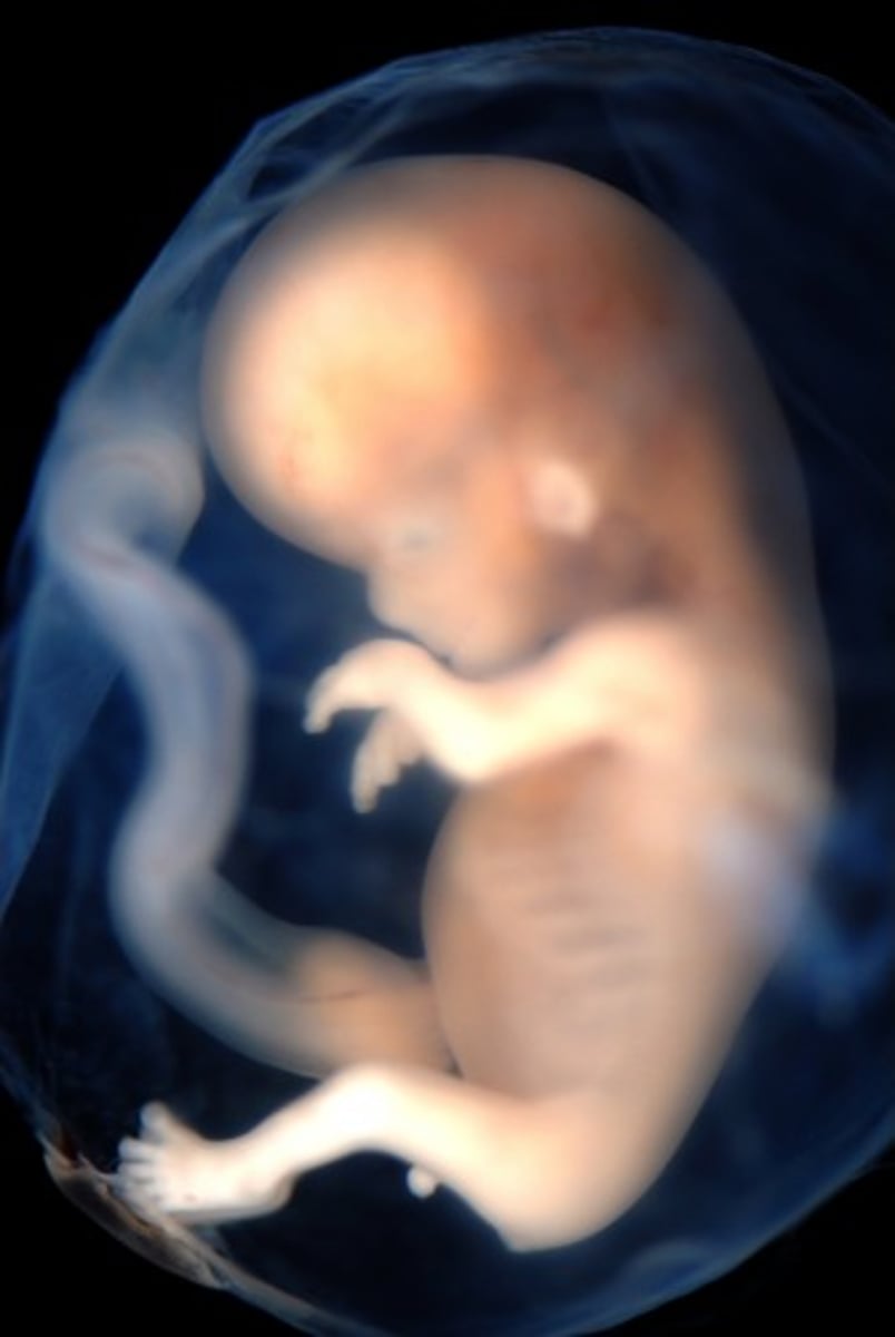 <p>/ˈfiːtəsɪz/ danh từ</p><p>thai nhi</p><p>The development of fetuses is closely monitored in the early stages of pregnancy.</p><p>embryo, unborn child</p><p>fetus (n)</p>