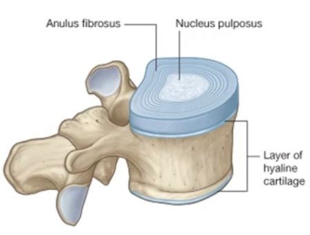 <p>-symphysis between adjacent vertebral bodies is <mark data-color="green" style="background-color: green; color: inherit">formed by a layer of hyaline cartilage AND an intervertebral disc lying between those cartilage layers</mark></p><p>-intervertebral disc is made up of: an <strong><mark data-color="green" style="background-color: green; color: inherit">outer anulus fibrosus and an inner nucleus pulposus</mark></strong></p><ul><li><p>nucleus pulposus is gelatinous early in life, then becomes harder with age</p></li></ul><p></p>