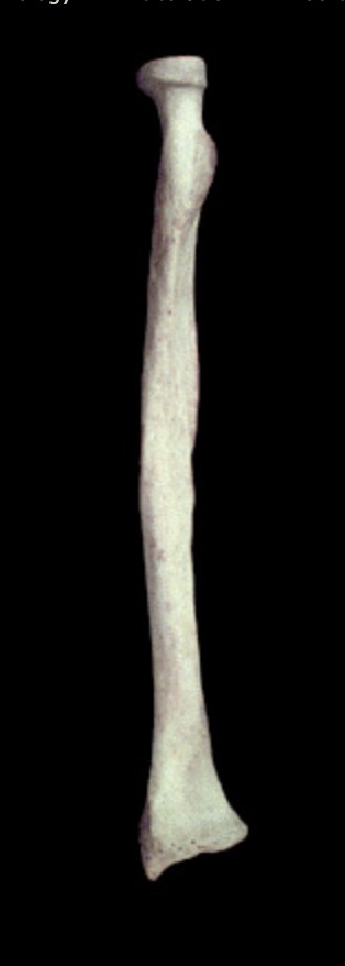 <p>What view is this? Anterior or posterior?</p>