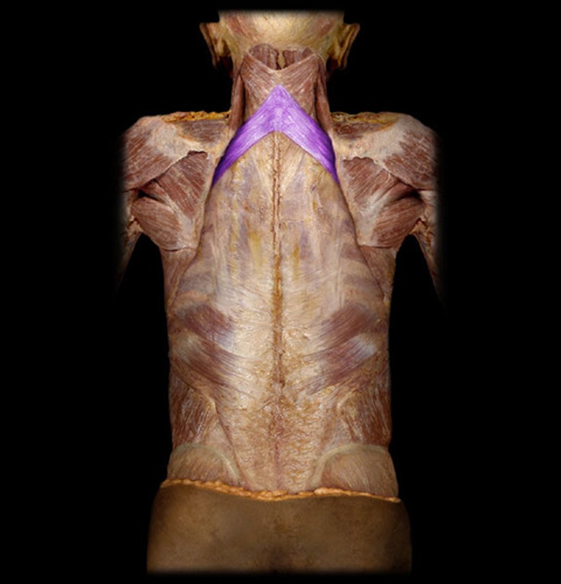 <p>Elevates ribs, located deep to rhomboids (paper thin)</p>