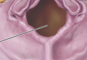 <p>large opening through which the spinal cord passes</p>