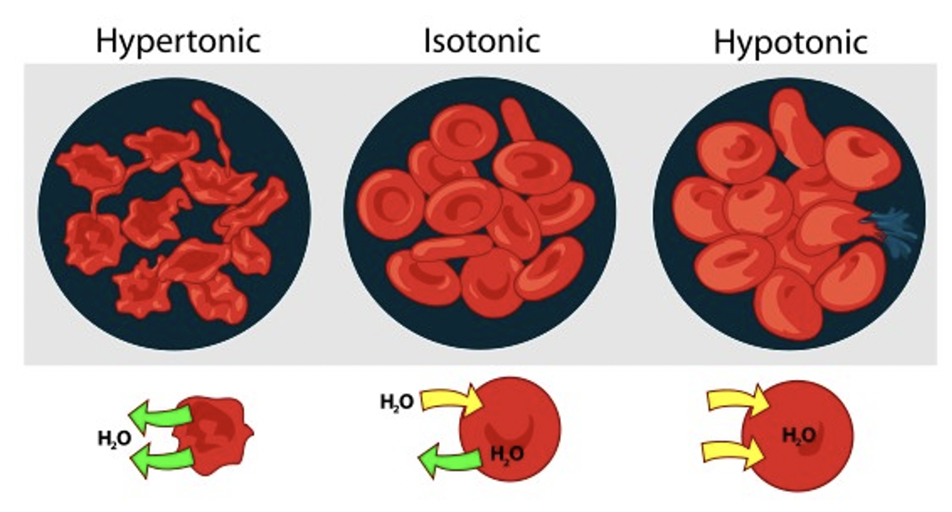 <p>isotonic - a solution having the SAME osmotic pressure as blood, same [solute] as RBC</p>
<p>hypertonic - a solution having HIGHER osmotic pressure , higher [solute] than blood (RBC will burst)</p>
<p>hypotonic - a solution having LOWER osmotic pressure than blood, lower [solute] than blood (RBC will shrivel up)</p>