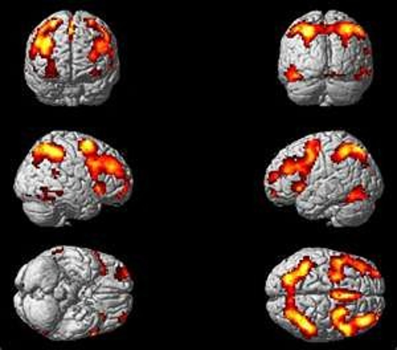 <p>technique that uses magnetic fields to visualize brain activity using changes in blood oxygen level</p>