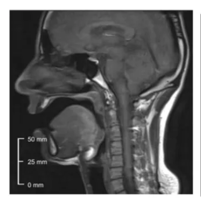 <p>articulated with the root of the tongue moving towards the ball wall of the pharynx</p>