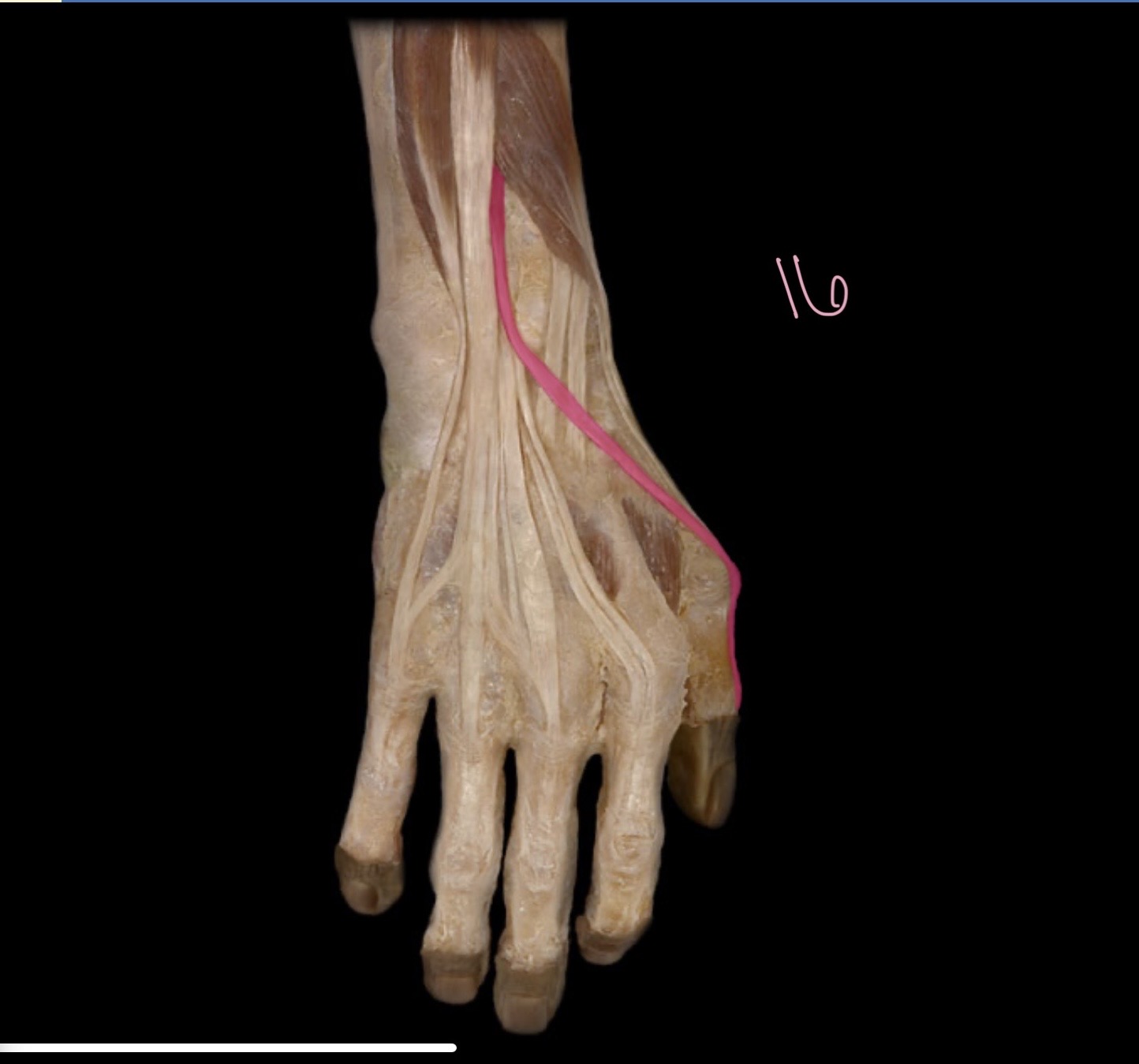 <p>Extensor pollicis m</p>