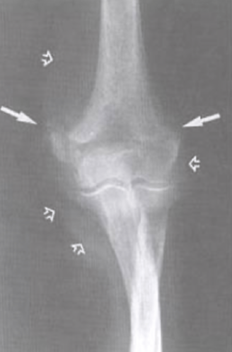 <p>What is the issue?</p>