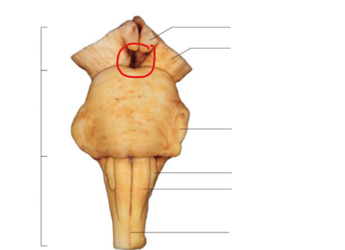 <p>What does the circled area refer to</p>