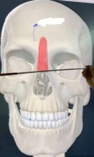 <p><strong>Nombre alterno: </strong>Prócer, Pilar interno del músculo frontal</p><p><strong><mark data-color="yellow" style="background-color: yellow; color: inherit">Origen: </mark></strong><mark data-color="yellow" style="background-color: yellow; color: inherit">Aponeurosis Hueso Nasal</mark></p><p><strong><mark data-color="blue" style="background-color: blue; color: inherit">Inserción:</mark></strong></p><p><mark data-color="blue" style="background-color: blue; color: inherit">Piel de la glabela<br>Vientre frontal&nbsp;del&nbsp;Epicranius</mark></p><p><strong><mark data-color="red" style="background-color: red; color: inherit">Acción:</mark></strong></p><p><mark data-color="red" style="background-color: red; color: inherit">Movimiento de cejas hacia abajo<br>Arrugas cutáneas transversales</mark></p><p><strong><mark data-color="purple" style="background-color: purple; color: inherit">Inervación: </mark></strong><mark data-color="purple" style="background-color: purple; color: inherit">Nervio&nbsp;Facial</mark><strong><br><mark data-color="green" style="background-color: green; color: inherit">Relaciones: </mark></strong><mark data-color="green" style="background-color: green; color: inherit">Cubren huesos nasales</mark></p><p><strong>Notas:</strong></p><p>Agonista del vientre&nbsp;<strong>frontal</strong><br>Su antagonista el es el&nbsp;<strong>corrugador</strong></p>