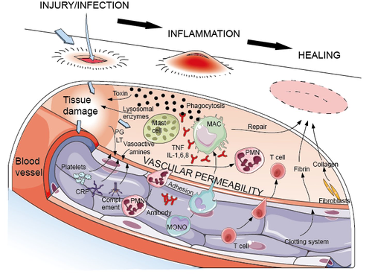 <p>- infection: noxious stimulus => acute inflammation (begins within minutes)</p><p>- lasts: < 10 days (chronic inflammation causes organ dysfunction &amp; necrosis)</p><p>- goal: eliminate causative agent &amp; injured tissue, begin tissue repair</p>