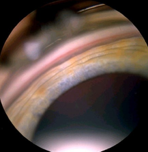 <p>identify </p>
