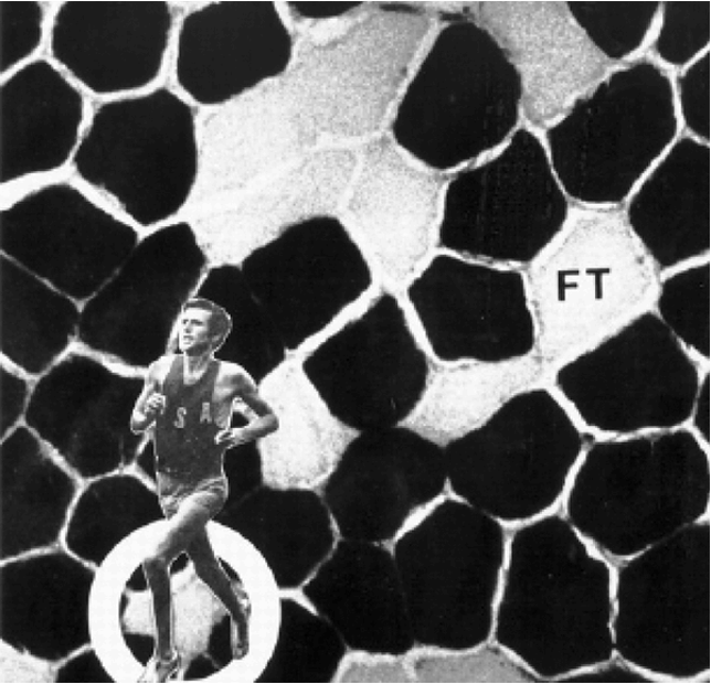 <p>What muscle trait shown here supports the idea that some athletes are "naturally gifted" for endurance sports?</p>