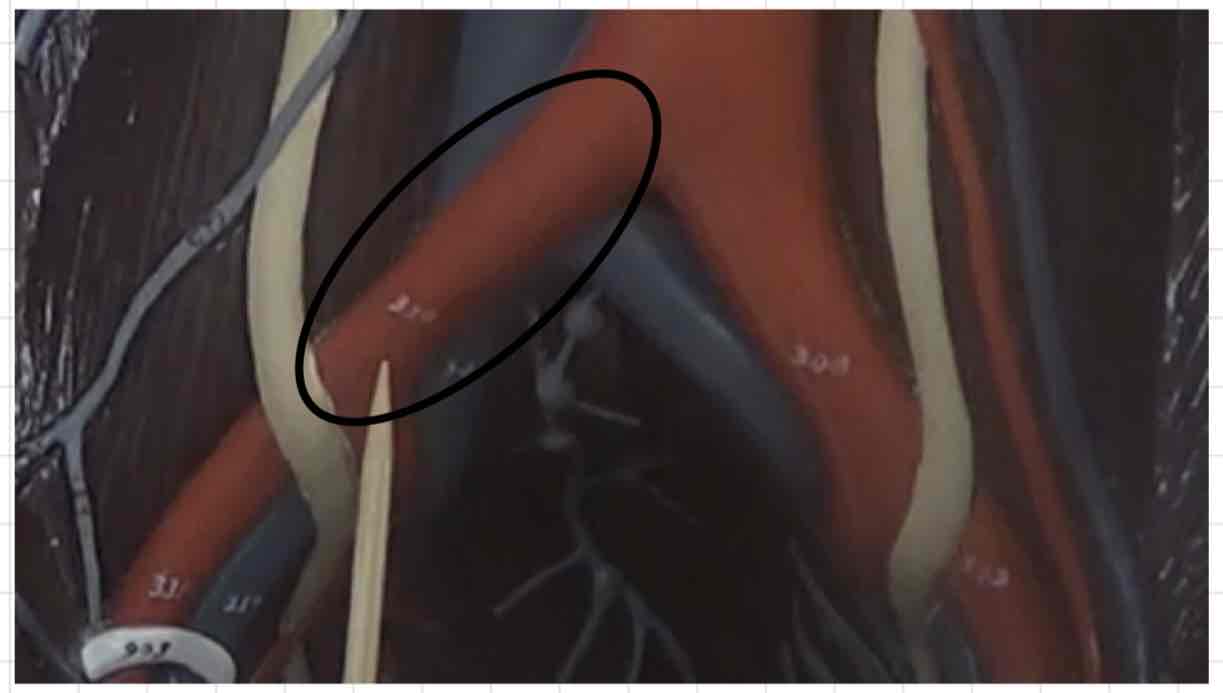 <p>what is this? (torso model)</p>