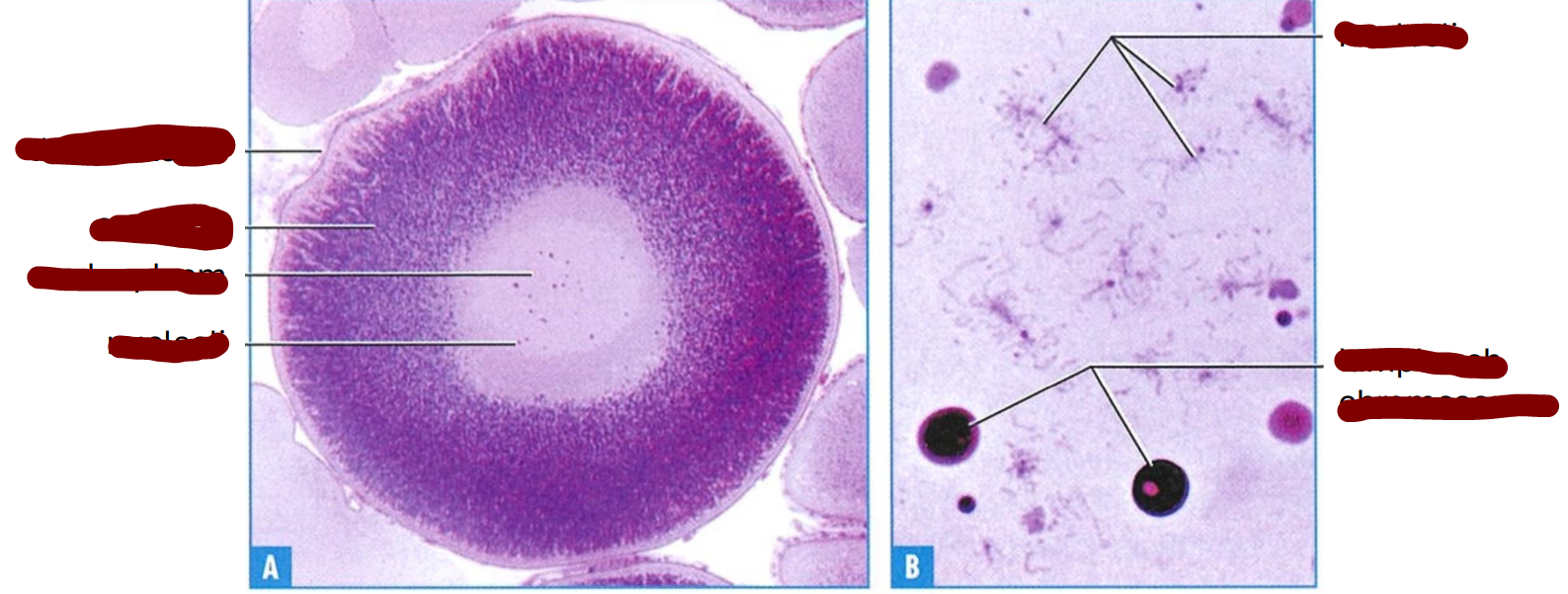 <p>section through a large frog primary oocyte</p>