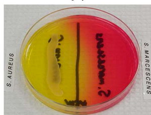 <p><span><strong><span>Mannitol Salt Agar (MSA)</span></strong></span></p>