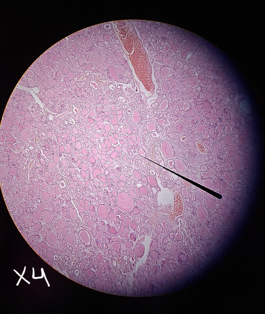 <p>Identify the tissue and mention one site</p>