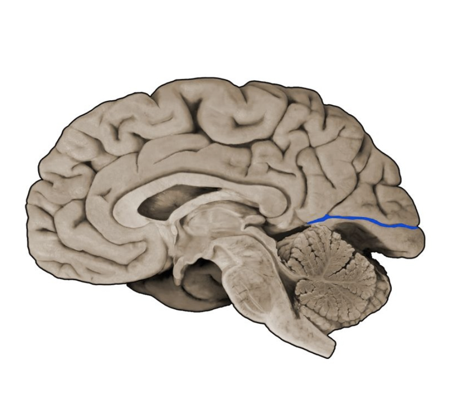 <p>A prominent sulcus in the medial occipital lobe formed by the cuneus and lingual gyral structures; this sulcus extends roughly horizontally from the parieto-occipital sulcus to its termination in the occipital pole. The calcarine sulcus contains the primary visual cortex (also called the "striate cortex").</p>