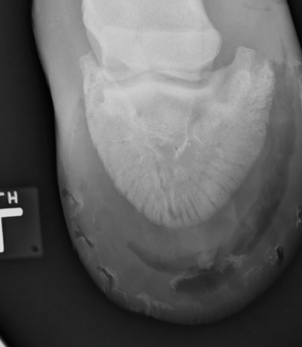 <p>What is highlighted in a DMPLO view of the foot?</p>