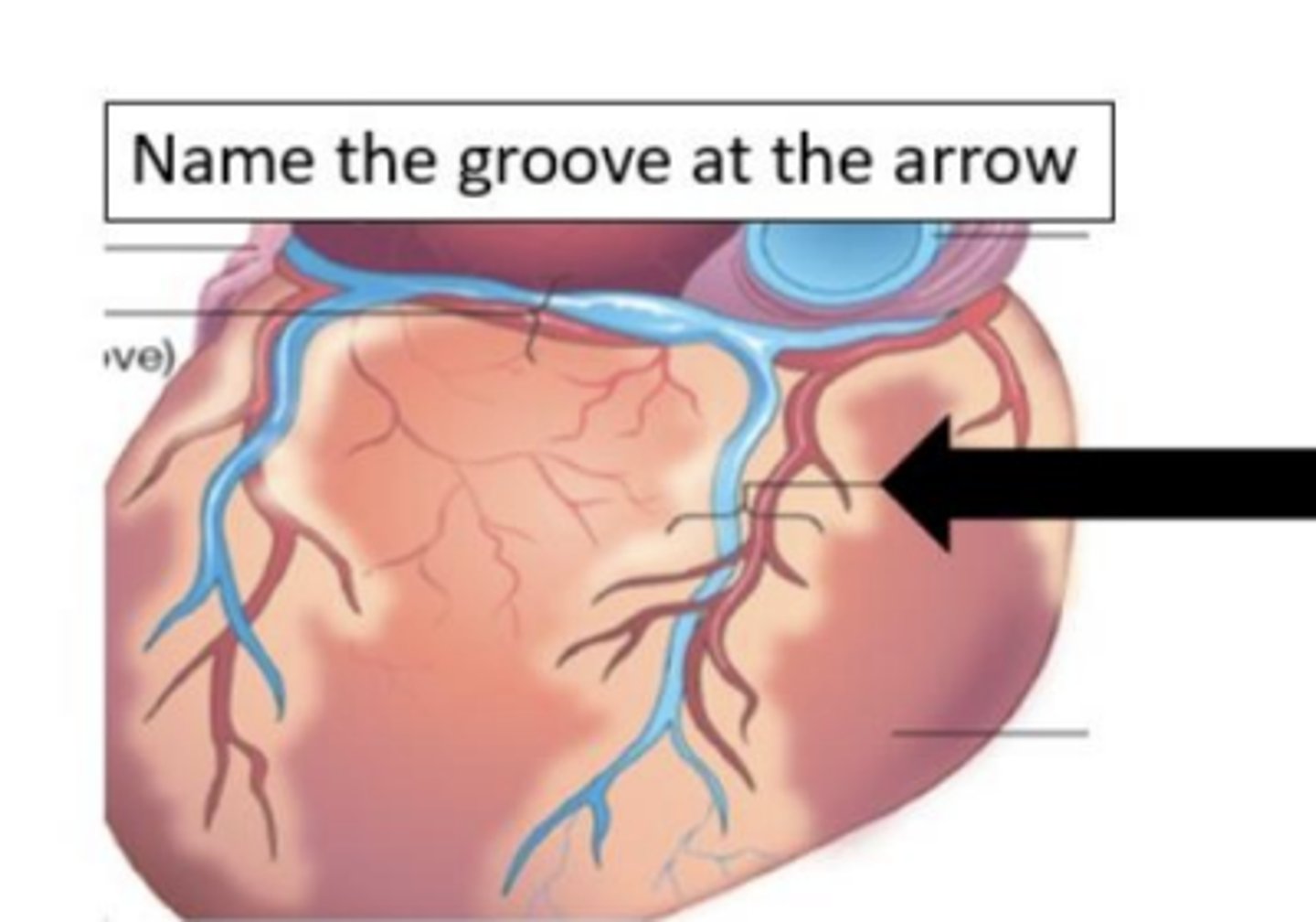 <p>What is the name of the groove at the arrow?</p>