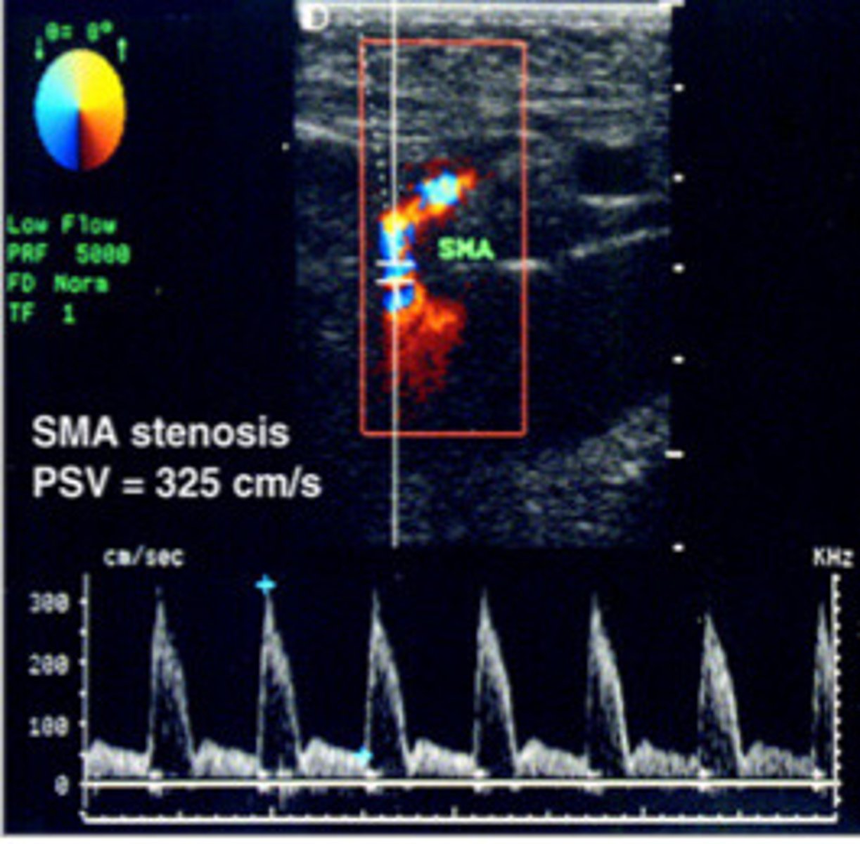 <p>What does this image show</p>