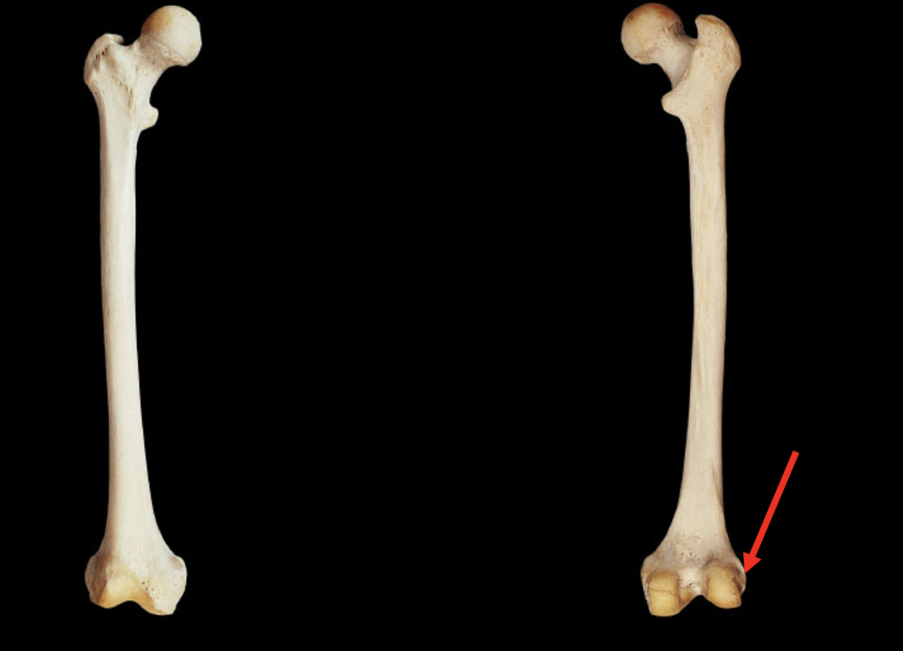 <p>Name this region of the femur</p>