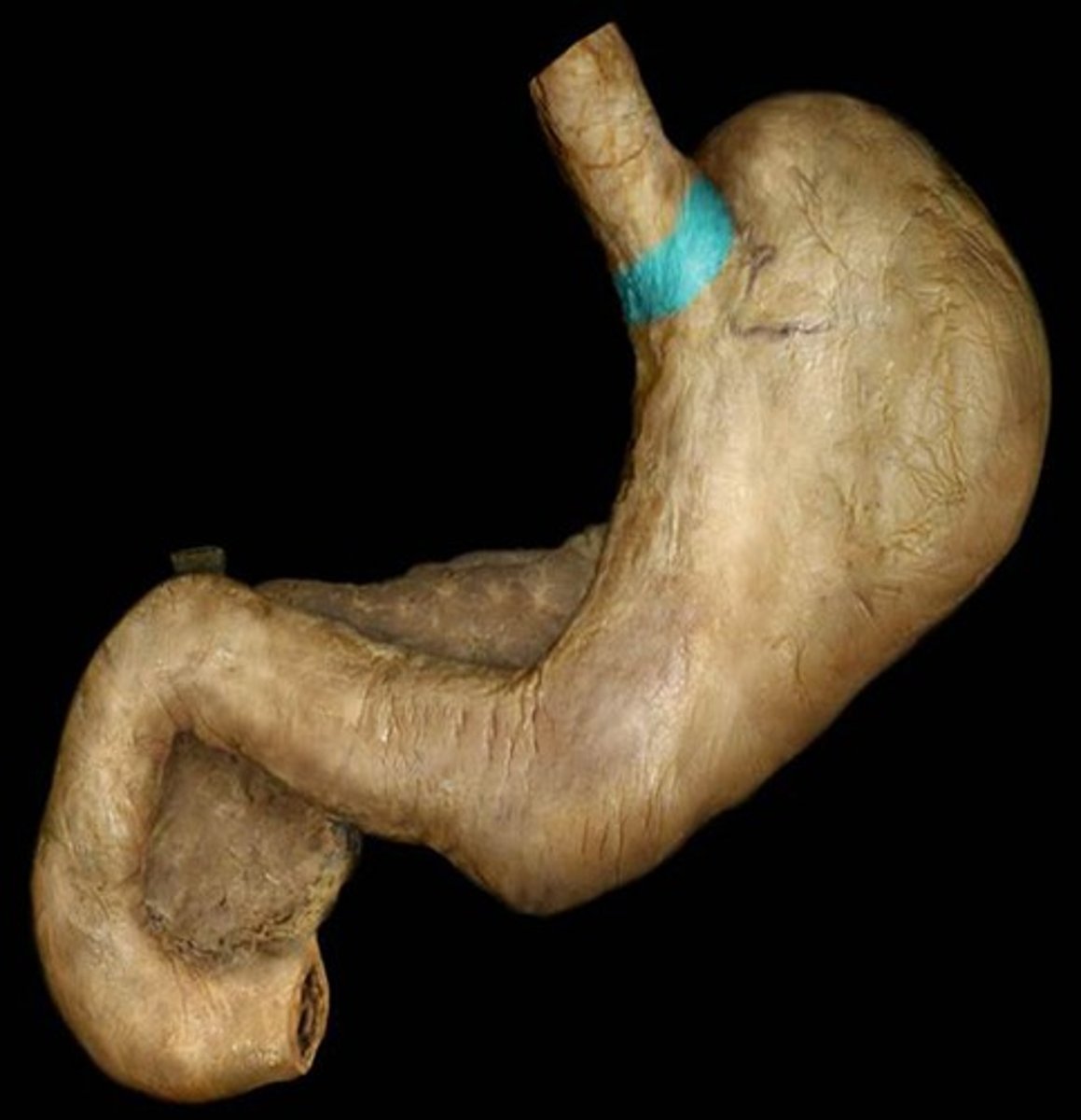 <p>What is the name of the region of the stomach highlighted in blue?</p>