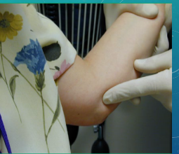 <p><strong>Medial Epicondylitis (Golfer’s Elbow): Background</strong></p><p>-Inflammation of wrist _______/___________ at medial epicondyle</p><ul><li><p>Pronator _____-______ carpi radialis muscles </p></li></ul><p>-Mechanism of Injury:</p><ul><li><p>Overuse-repetitive wrist flexion and ___________</p></li></ul><p>-S/S:</p><ul><li><p>TTP over the medial ___________ and proximal wrist flexors </p></li><li><p>Pain with resisted wrist _______ and pronation</p></li><li><p>Pain with _________ wrist extension </p></li></ul><p></p>