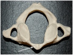 Name this specific part of the atlas (C1).