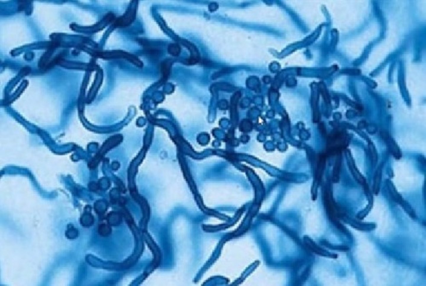 <p>Causes tinea versicolor</p><p>• Requires lipid source</p><p>(sterile olive oil)</p><p>• Yeast with "spaghetti and</p><p>meatballs" morphology</p>