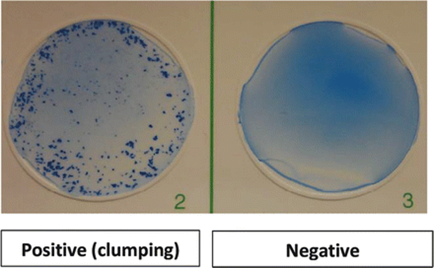 <p>antigens are whole cells or organisms such as red blood cells, bacteria, or viruses displaying surface antigens</p><p>-forms visible clumps of cells</p><p>-used to determine blood compatibility</p>