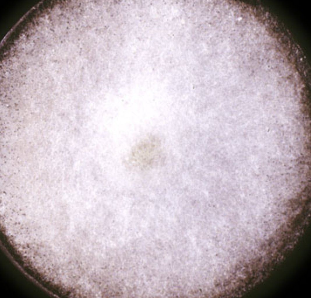 <p>What organism is this? Obverse or reverse?</p>
