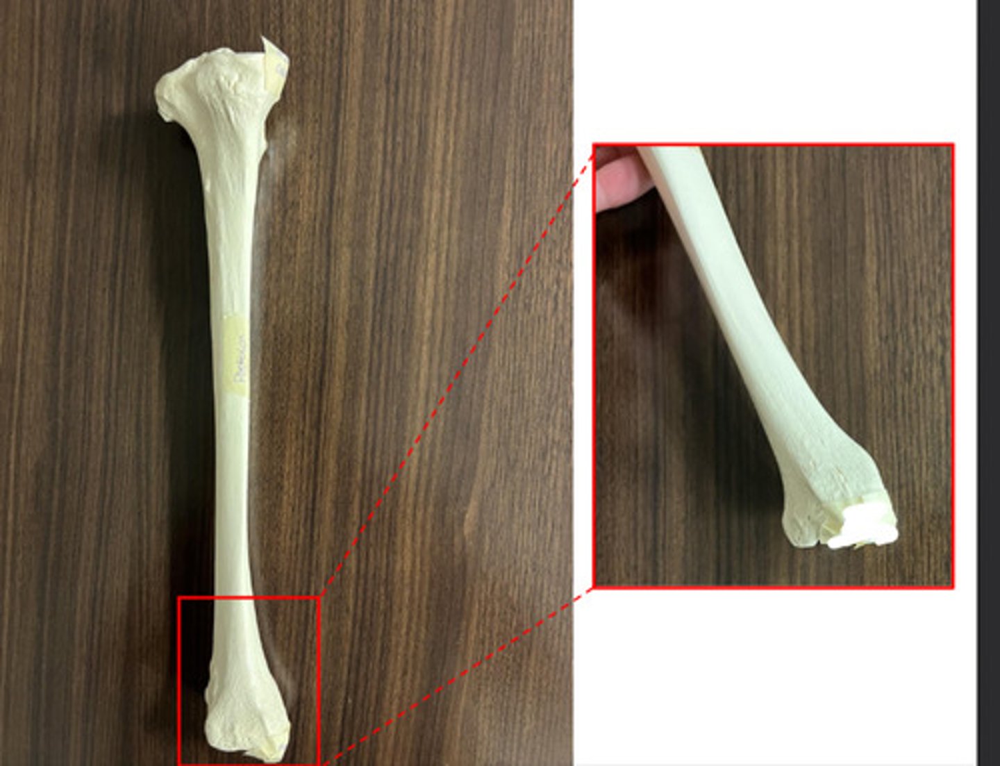 <p>what structure is this?</p>