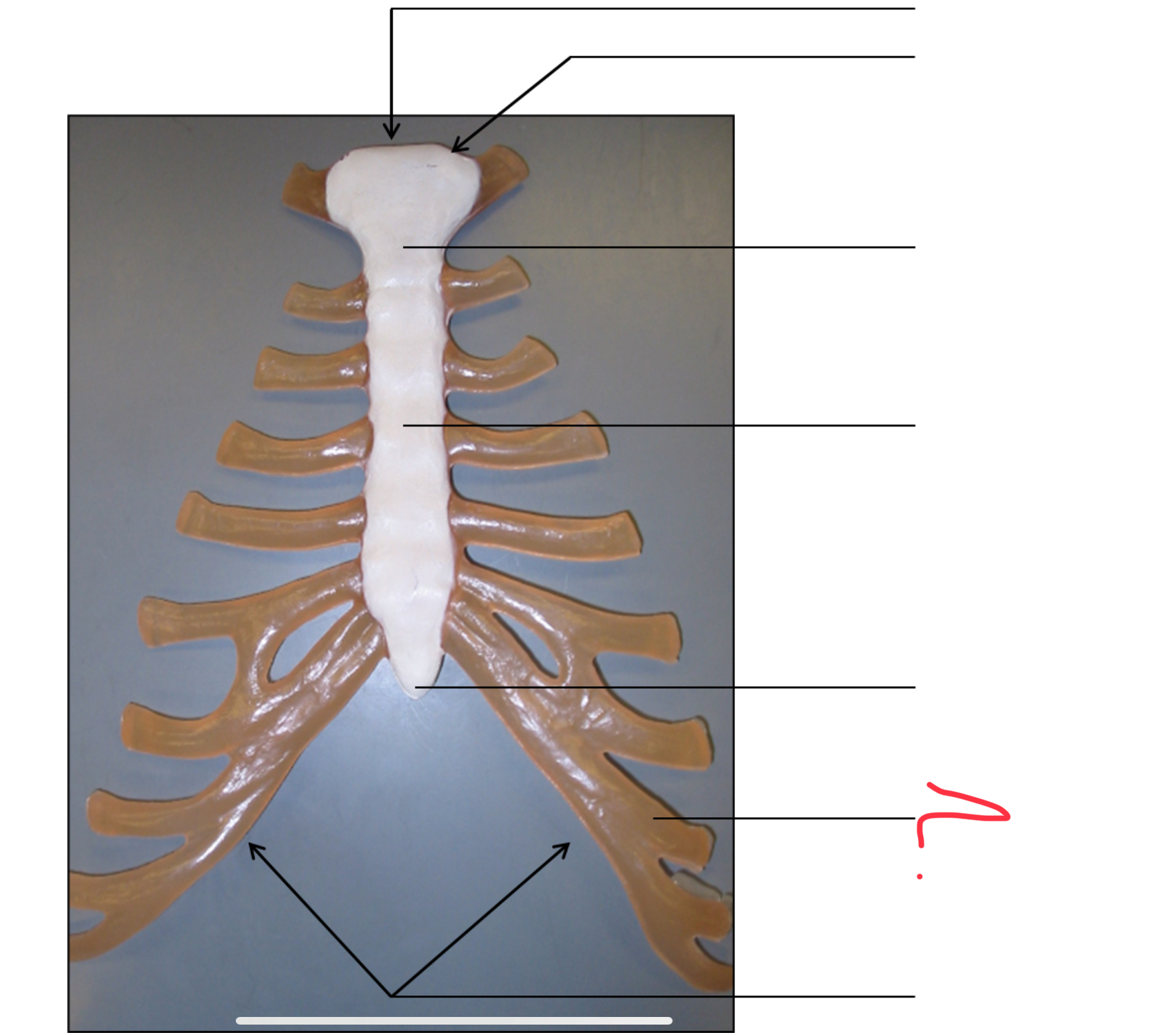 <p>costal cartilages</p>