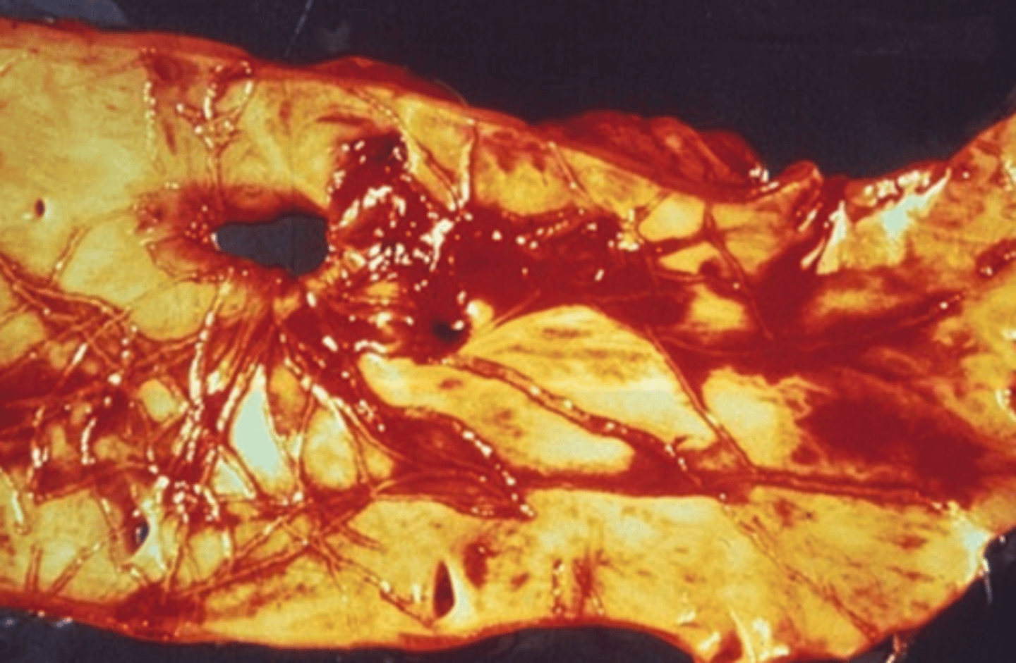 <p>fibrin tracks in the aorta of a horse due to migrating larva. what species of parasite is this?</p>