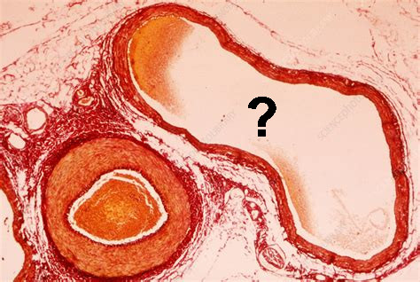 <p>Is this a vein or an artery?</p>